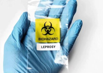 В Европе выявили проказу: средневековое заболевание обнаружили у границ с Украиной