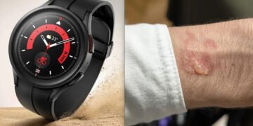 Samsung Galaxy Watch перегріваються та залишають опіки: що відомо